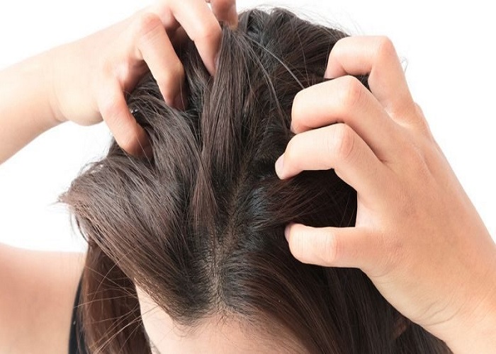 Scalp itching problem solution